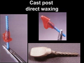 1 Post and core-1 (Muhadharaty)rrrr.pptx