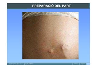 PREPARACIÓ DEL PART
 