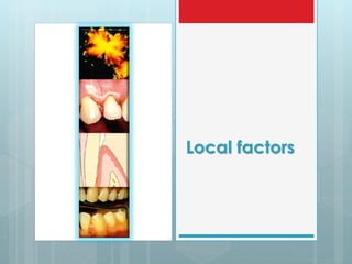 prevention of periodontal diseases | PDF