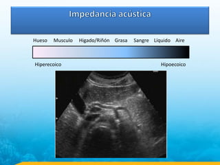 Hueso Musculo Higado/Riñón Grasa Sangre Líquido Aire
Hiperecoico Hipoecoico
 