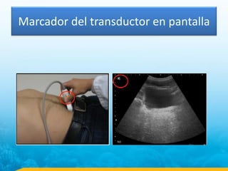 Marcador del transductor en pantalla
 