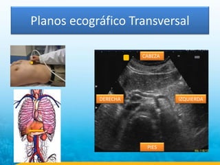 Planos ecográfico Transversal
CABEZA
DERECHA IZQUIERDA
PIES
 