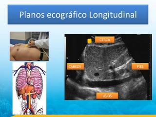 Planos ecográfico Longitudinal
CABEZA
CERCA
LEJOS
PIES
 
