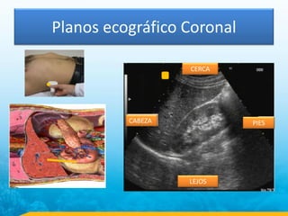 Planos ecográfico Coronal
CABEZA
CERCA
LEJOS
PIES
 