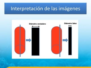 Interpretación de las imágenes
 