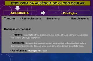 ETIOLOGIA DA AUSÊNCIA DO GLOBO OCULAR
ADQUIRIDA - Patológica
- Tumores: - Retinoblastoma - Melanoma - Neuroblastoma
- Doenças corneanas:
- Tracoma: inflamação crônica e recidivante, que afeta a córnea e a conjuntiva, provocada
pela bactéria Chlamydia trachomatis
- Glaucoma: aumento da pressão intraocular, que provoca o endurecimento do globo e
determina uma compressão do nervo óptico tendo como efeito diminuir a acuidade visual.
- Panoftalmia: inflamação intraocular
 