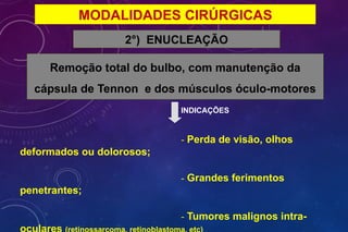 MODALIDADES CIRÚRGICAS
2°) ENUCLEAÇÃO
Remoção total do bulbo, com manutenção da
cápsula de Tennon e dos músculos óculo-motores
INDICAÇÕES
- Perda de visão, olhos
deformados ou dolorosos;
- Grandes ferimentos
penetrantes;
- Tumores malignos intra-
oculares (retinossarcoma, retinoblastoma, etc)
 