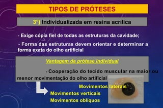 TIPOS DE PRÓTESES
3°) Individualizada em resina acrílica
- Exige cópia fiel de todas as estruturas da cavidade;
- Forma das estruturas devem orientar e determinar a
forma exata do olho artificial
Vantagem da prótese individual
- Cooperação do tecido muscular na maior ou
menor movimentação do olho artificial
Movimentos laterais
Movimentos verticais
Movimentos oblíquos
 