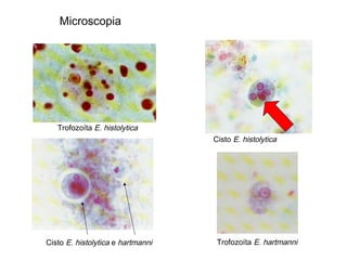 Microscopia
Trofozoíta E. histolytica
Cisto E. histolytica
Cisto E. histolytica e hartmanni Trofozoíta E. hartmanni
 