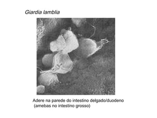 Adere na parede do intestino delgado/duodeno
(amebas no intestino grosso)
Giardia lamblia
 