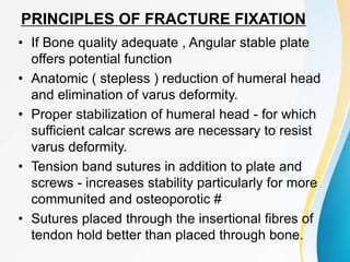 PRINCIPLES OF FRACTURE FIXATION
• If Bone quality adequate , Angular stable plate
offers potential function
• Anatomic ( stepless ) reduction of humeral head
and elimination of varus deformity.
• Proper stabilization of humeral head - for which
sufficient calcar screws are necessary to resist
varus deformity.
• Tension band sutures in addition to plate and
screws - increases stability particularly for more
communited and osteoporotic #
• Sutures placed through the insertional fibres of
tendon hold better than placed through bone.
 
