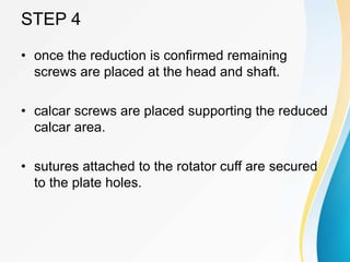 STEP 4
• once the reduction is confirmed remaining
screws are placed at the head and shaft.
• calcar screws are placed supporting the reduced
calcar area.
• sutures attached to the rotator cuff are secured
to the plate holes.
 