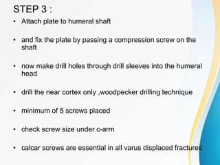 STEP 3 :
• Attach plate to humeral shaft
• and fix the plate by passing a compression screw on the
shaft
• now make drill holes through drill sleeves into the humeral
head
• drill the near cortex only ,woodpecker drilling technique
• minimum of 5 screws placed
• check screw size under c-arm
• calcar screws are essential in all varus displaced fractures
 
