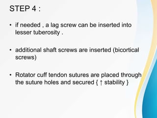 STEP 4 :
• if needed , a lag screw can be inserted into
lesser tuberosity .
• additional shaft screws are inserted (bicortical
screws)
• Rotator cuff tendon sutures are placed through
the suture holes and secured { ↑ stability }
 