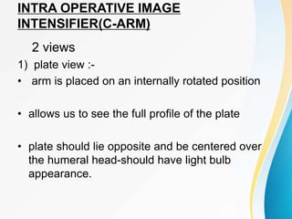 INTRA OPERATIVE IMAGE
INTENSIFIER(C-ARM)
2 views
1) plate view :-
• arm is placed on an internally rotated position
• allows us to see the full profile of the plate
• plate should lie opposite and be centered over
the humeral head-should have light bulb
appearance.
 