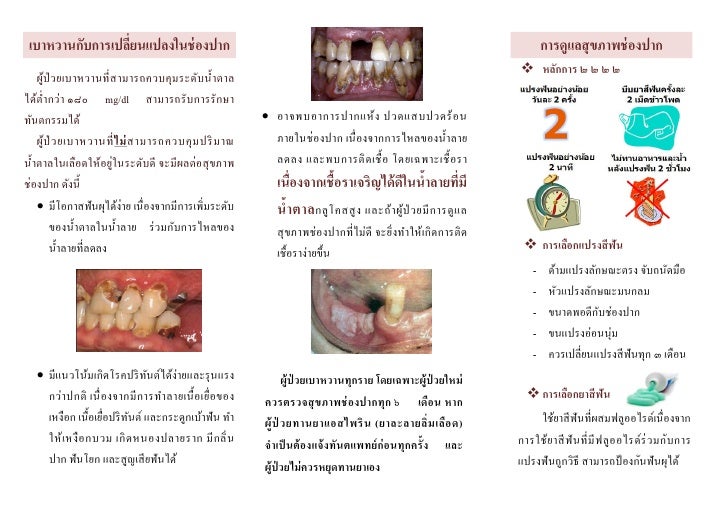 การดูแลสุขภาพ