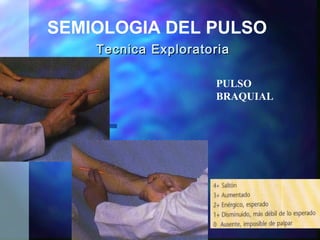 Pulso Triangular 1 pulsos | PPT