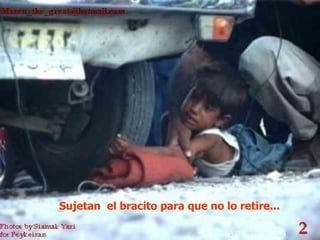 Sujetan el bracito para que no lo retire...
 