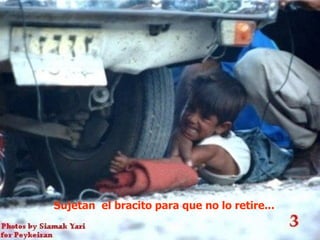 Sujetan el bracito para que no lo retire...
 