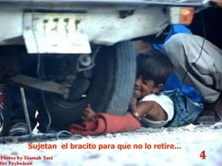 Sujetan el bracito para que no lo retire...
 