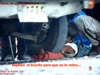 Sujetan el bracito para que no lo retire...
 