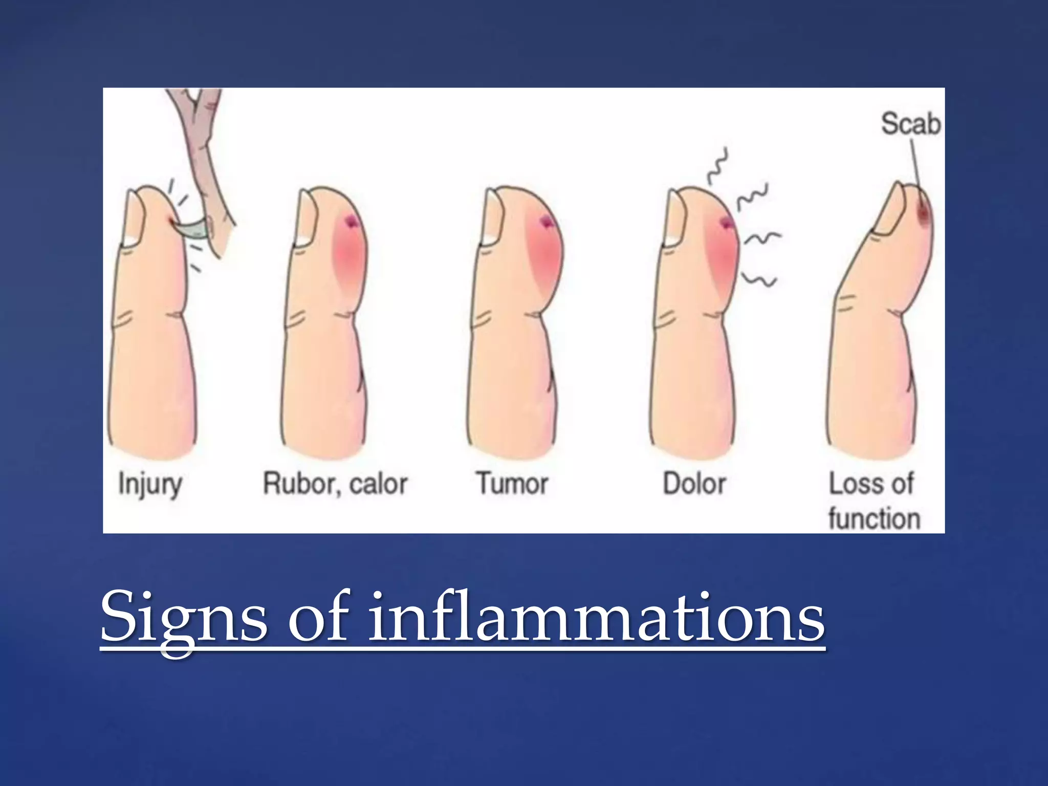 Signs of inflammations
 