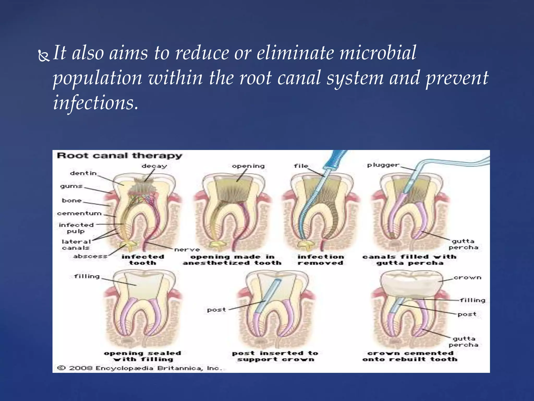  It also aims to reduce or eliminate microbial
population within the root canal system and prevent
infections.
 