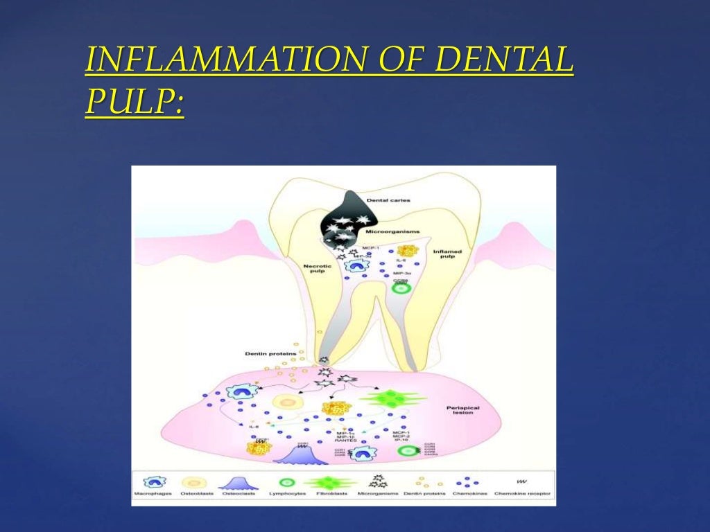 Rationale of endodontics
