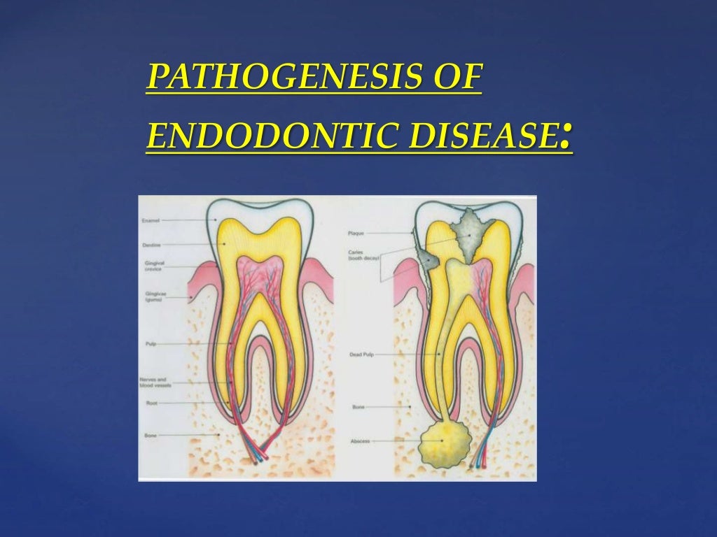 Rationale of endodontics