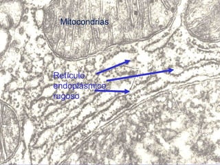 Mitocondrias Retículo endoplásmico rugoso 