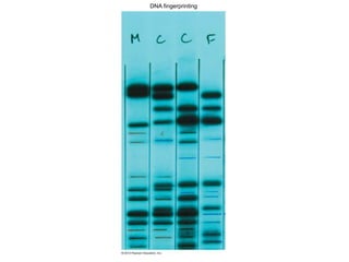 DNA fingerprinting
 