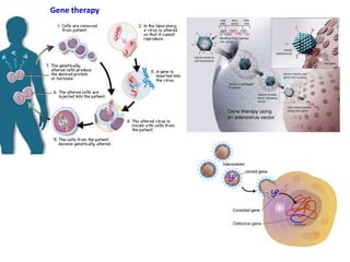 Gene therapy
 