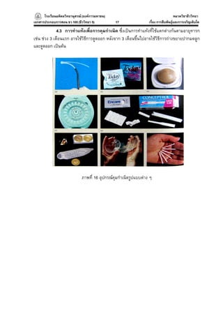 โรงเรียนมหิดลวิทยานุสรณ (องคการมหาชน)
                                     ารมหาชน)                                         หมวดวิชาชีววิทยา
                                                                                                    ยา
เอกสารประกอบการสอน ชว 105 (ชีววิทยา 5)          17                 เรื่อง การสืบพันธุและการเจริญเติบโต

              4.3 การทําแทงเพื่อการคุมกําเนิด ซึ่งเปนการทําแทงที่ใชแตกตางกันตามอายุทารก
เชน ชวง 3 เดือนแรก อาจใชวิธีการดูดออก หลังจาก 3 เดือนขึ้นไปอาจใชวิธีการถางขยายปากมดลูก
และดูดออก เปนตน




                              ภาพที่ 16 อุปกรณคุมกําเนิดรูปแบบตาง ๆ
 