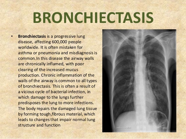 1 respiratory and circulatory common diseases