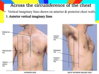 Line Between Chest Review of anatomy and physiology of respiratory system | PPTX