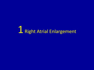 1Right Atrial Enlargement
 