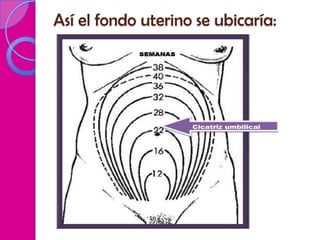 Así el fondo uterino se ubicaría:
 