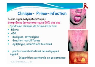 Clinique- Primo-infection
Aucun signe (asymptomatique)
Symptômes (symptomatique) 50% des cas
(Syndrome clinique de Primo-infection:
fièvre
ADPADP
myalgies, arthralgies
éruption morbiliforme
dysphagie, ulcérations buccales
parfois manifestations neurologiques
aiguës
Disparition spontanée en qq semaines.
Mouffok N- VIH/SIDA Cours nov 2013
 