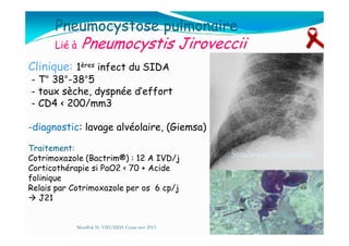 Pneumocystose pulmonaire
Lié à Pneumocystis Jiroveccii
Clinique: 1ères infect du SIDA
- T° 38°-38°5
- toux sèche, dyspnée d’effort
- CD4 < 200/mm3
-diagnostic: lavage alvéolaire, (Giemsa)-diagnostic: lavage alvéolaire, (Giemsa)
Syndrome interstitielSyndrome interstitiel
Mouffok N- VIH/SIDA Cours nov 2013
Traitement:
Cotrimoxazole (Bactrim®) : 12 A IVD/j
Corticothérapie si PaO2 < 70 + Acide
folinique
Relais par Cotrimoxazole per os 6 cp/j
J21
 