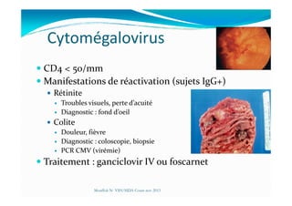 Cytomégalovirus
CD4 < 50/mm
Manifestations de réactivation (sujets IgG+)
Rétinite
Troubles visuels, perte d’acuitéTroubles visuels, perte d’acuité
Diagnostic : fond d’oeil
Colite
Douleur, fièvre
Diagnostic : coloscopie, biopsie
PCR CMV (virémie)
Traitement : ganciclovir IV ou foscarnet
Mouffok N- VIH/SIDA Cours nov 2013
 
