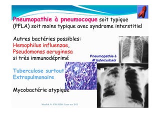 Pneumopathie à pneumocoque soit typique
(PFLA) soit moins typique avec syndrome interstitiel
Autres bactéries possibles:
Hemophilus influenzae,
Pseudomonas aeruginosa
si très immunodéprimé Pneumopathie à
si très immunodéprimé
Tuberculose surtout
Extrapulmonaire
Mycobactérie atypique
Mouffok N- VIH/SIDA Cours nov 2013
Pneumopathie à
M tuberculosis
 