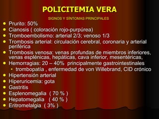 POLICITEMIA VERA SIGNOS Y SÍNTOMAS PRINCIPALES Prurito: 50% Cianosis ( coloración rojo-purpúrea) Tromboembolismo: arterial 2/3; venoso 1/3 Trombosis arterial: circulación cerebral, coronaria y arterial periférica Trombosis venosa: venas profundas de miembros inferiores, venas esplénicas, hepáticas, cava inferior, mesentéricas,  Hemorragias: 20 – 40%  principalmente gastrointestinales trombopatía , enfermedad de von Willebrand, CID crónico Hipertensión arterial  Hiperuricemia: gota Gastritis Esplenomegalia  ( 70 % ) Hepatomegalia  ( 40 % ) Eritromelalgia  ( 3% ) 