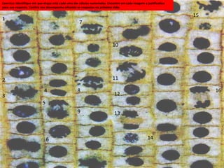 1
10
139
8
7
6
5
4
3
2
14
11
16
15
12
Exercíco: Identifique em que etapa está cada uma das células numeradas. Encontre em cada imagem a justificativa
para sua resposta. Confira seu desempenho olhando as respostas no prõximo slide.
 