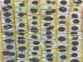 1 anáfase
10 prófase
Observar RNP
13 Telófase – veja
Citocinese centífuga
9 Intérfaase-
célula madura,
grande citoplasma
8 anáfase
7Início de anáfase
Já há espaço entre
Os cromossomos
( separação das
cromátides)
6 Profase
5 anáfase
4 duas células jovens
em intérfase
3Metáfase
2Prófase
14Prófase
11anáfase
16 fim de anáfase
15 metáfase
12 telófase ou início
de intérfase
 