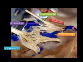 1 Anatomía microquirúrgica del seno cavernoso y fosa media | PPT