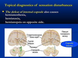 Topical diagnostics of sensation disturbancesTopical diagnostics of sensation disturbances
 The defeat of internal capsuleThe defeat of internal capsule also causesalso causes
hemianesthesia,hemianesthesia,
hemiataxia,hemiataxia,
hemianopsia on opposite side.hemianopsia on opposite side.
Capsula
interna
 