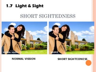 SHORT SIGHTEDNESS NORMAL VISSION SHORT SIGHTEDNESS 1.7 Light & Sight 