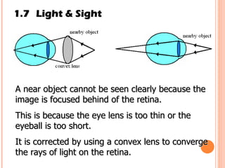 1.7 Light & Sight A near object cannot be seen clearly because the image is focused behind of the retina. This is because the eye lens is too thin or the eyeball is too short. It is corrected by using a convex lens to converge the rays of light on the retina. 