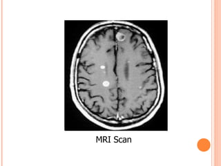 MRI Scan  