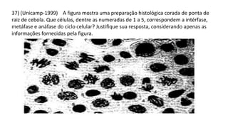 37) (Unicamp-1999) A figura mostra uma preparação histológica corada de ponta de
raiz de cebola. Que células, dentre as numeradas de 1 a 5, correspondem a intérfase,
metáfase e anáfase do ciclo celular? Justifique sua resposta, considerando apenas as
informações fornecidas pela figura.
 